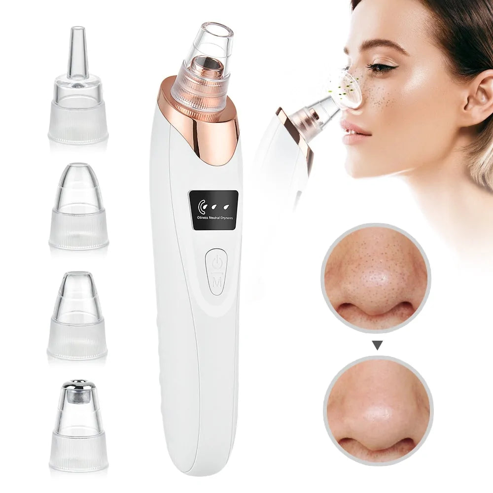 Orelle PorePro™ – Advanced Blackhead Vacuum